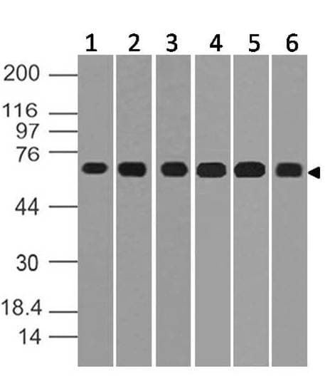 Polyclonal Rabbit anti-Rat IRAK2 / IRAK-2 Antibody (WB)
