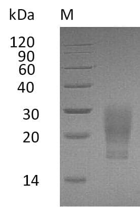Human CSF2 / GM-CSF Protein (Recombinant 6His, C-terminus)