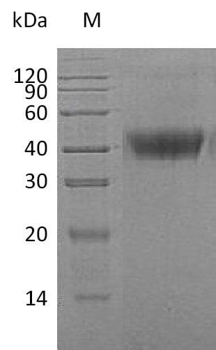 Human CSF1 / MCSF Protein (Recombinant 6His, C-terminus)