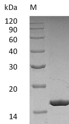 Human CSF3 / G-CSF Protein (Recombinant)
