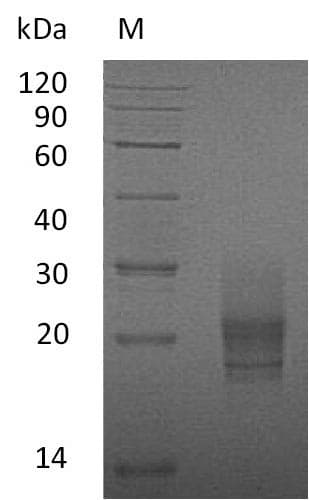 Mouse CSF2 / GM-CSF Protein (Recombinant 6His, C-terminus)
