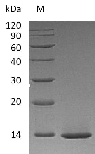 Human NGF Protein (Recombinant)
