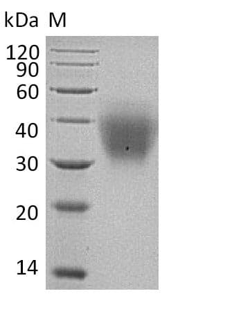 Human KITLG / SCF Protein (Recombinant 6His, C-terminus)