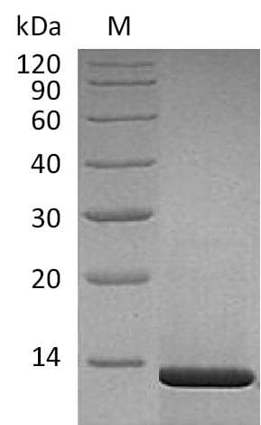 Human NGF Protein (Recombinant)