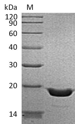Human TNF Alpha Protein (Recombinant 6His, N-terminus)