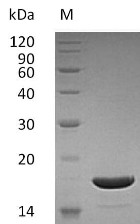 Human TNFSF10 / TRAIL Protein (Recombinant)