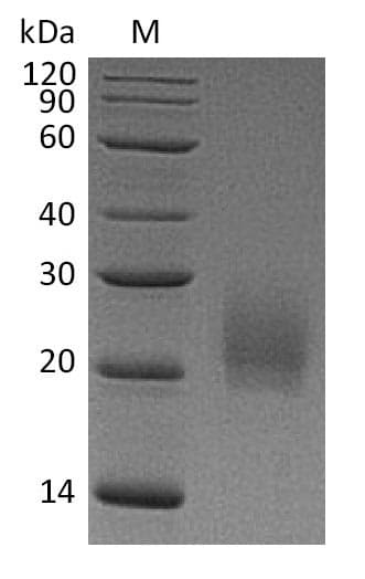 Mouse CTLA4 / CD152 Protein (Recombinant 6His, C-terminus)