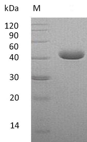 Human PVRL4 / Nectin 4 Protein (Recombinant 6His, C-terminus)