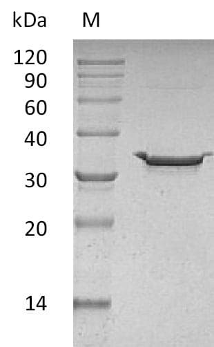 Human CA-VB / CA5B Protein (Recombinant 6His, C-terminus)