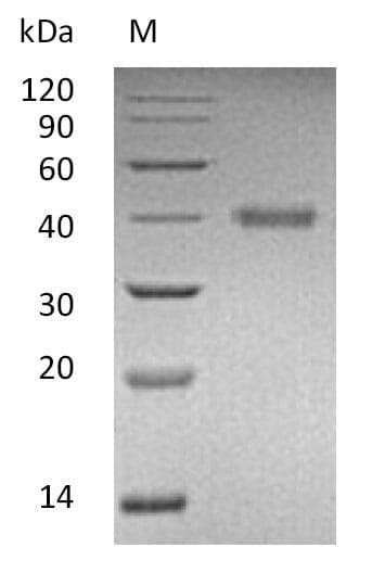 Human RSPO1 / RSPO Protein (Recombinant 6His, C-terminus)