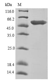 Human EEF1A1 Protein (Recombinant 6His, N-terminus)