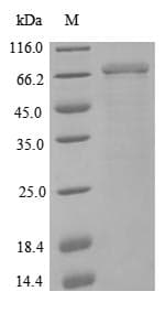 Human NCAM / CD56 Protein (Recombinant 6His, N-terminus)