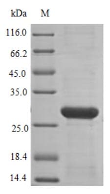 Human NOX4 Protein (Recombinant 6His, N-terminus)