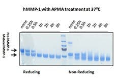 Human MMP1 Protein (Recombinant)