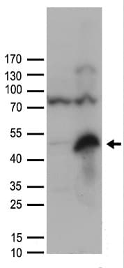 ZP3 Antibody
