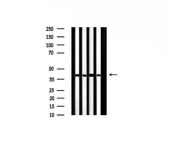 Polyclonal Rabbit anti-Human ILKAP Antibody (IHC, IF, WB)