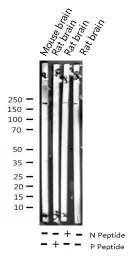 IRS1 Antibody (phospho-Ser312)