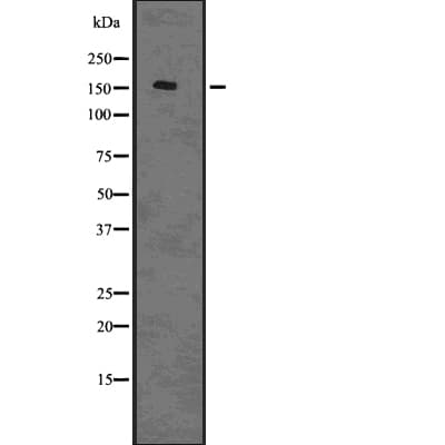 CLSPN / Claspin Antibody