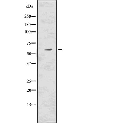 Polyclonal Rabbit anti-Human CAT / Catalase Antibody (IHC, IF, WB)