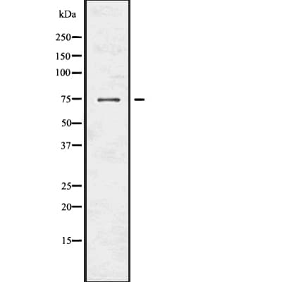Polyclonal Rabbit anti-Human NUMB Antibody (IF, WB)