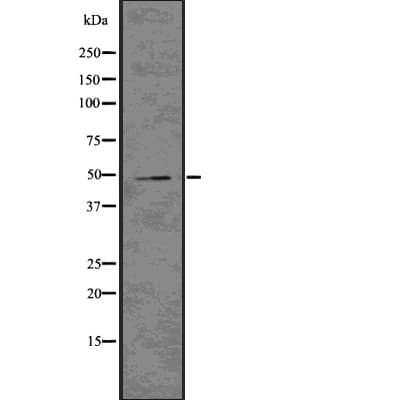 Polyclonal Rabbit anti-Human PLIN2 / ADFP / Adipophilin Antibody (WB)