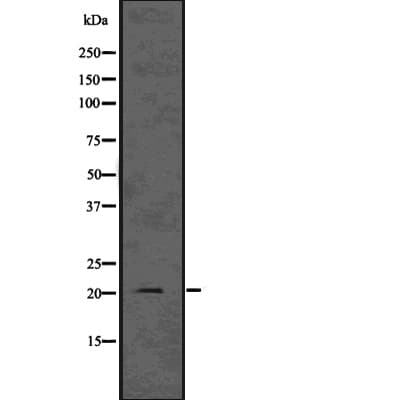 Polyclonal Rabbit anti-Human HRAS / H-Ras Antibody (WB)