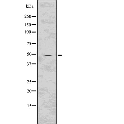 Polyclonal Rabbit anti-Human HTRA2 / OMI Antibody (WB)