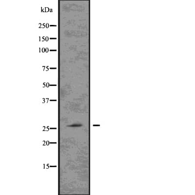 Polyclonal Rabbit anti-Human LAT Antibody (IF, WB)