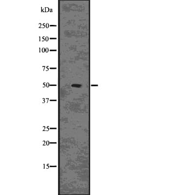 Polyclonal Rabbit anti-Human CHGA / Chromogranin A Antibody (WB)