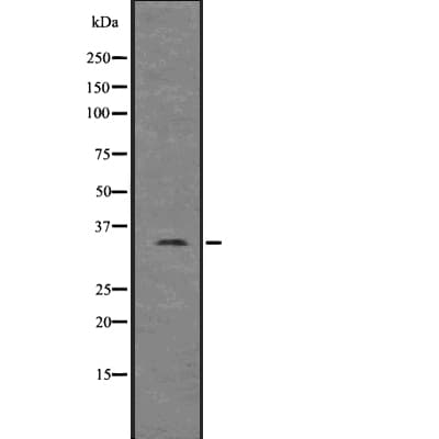 Polyclonal Rabbit anti-Human UCP1 / UCP-1 Antibody (IHC, WB)