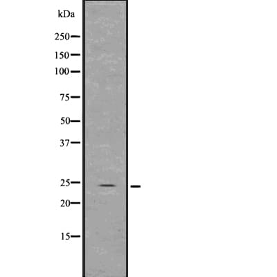 Polyclonal Rabbit anti-Human GDNF Antibody (WB)