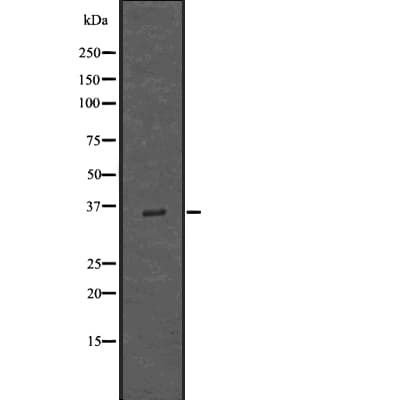 Polyclonal Rabbit anti-Human IBSP / Bone Sialoprotein Antibody (IF, WB)