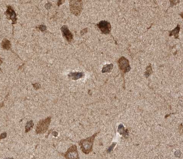 Polyclonal Rabbit anti-Human PINK1 Antibody (IHC, IF, WB)