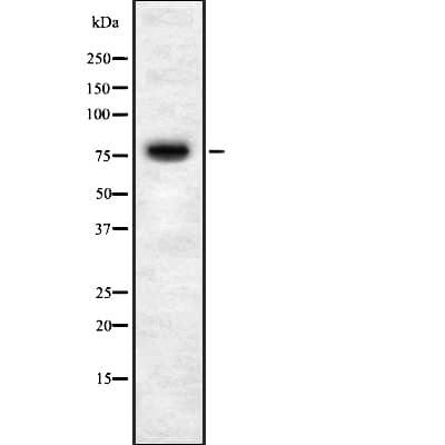 Polyclonal Rabbit anti-Human GOK / STIM1 Antibody (WB)