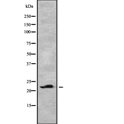 Polyclonal Rabbit anti-Human CLEC3B / Tetranectin Antibody (WB)