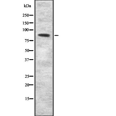 Polyclonal Rabbit anti-Human SEMA3F / Semaphorin 3F Antibody (WB)