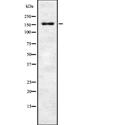 Polyclonal Rabbit anti-Human MAP3K1 / MEKK1 Antibody (phospho-Thr1402, IHC, IF, WB)