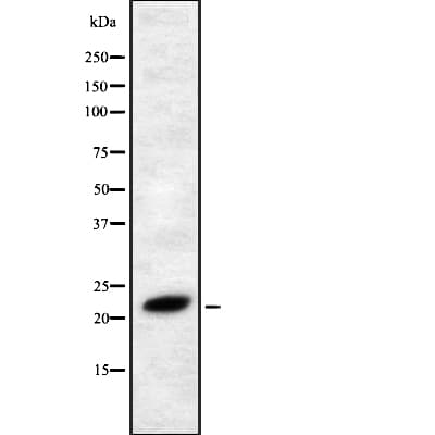 Polyclonal Rabbit anti-Human FGF4 Antibody (WB)