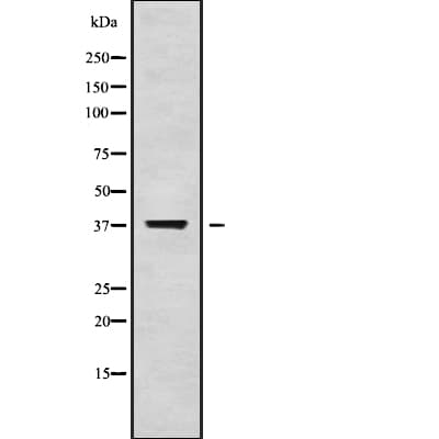 Polyclonal Rabbit anti-Human BM022 / MRPL1 Antibody (WB)