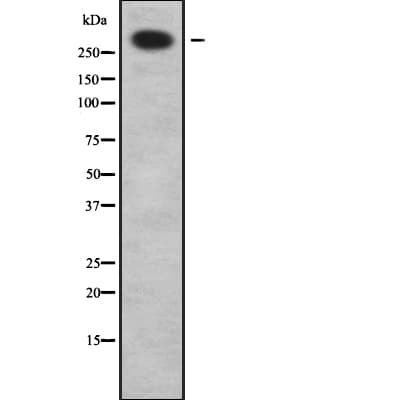 LI2 / Abca12 Antibody