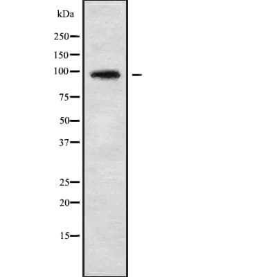 Polyclonal Rabbit anti-Human AXIN1 / Axin-1 Antibody (WB)