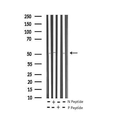Polyclonal Rabbit anti-Human ATF2 Antibody (phospho-Ser62,phospho-Ser44, IHC, IF, WB)