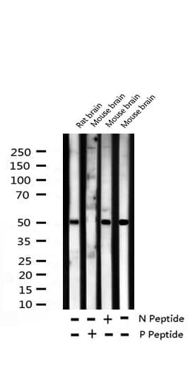 Polyclonal Rabbit anti-Human ATF2 Antibody (phospho-Thr69,phospho-Thr51, IHC, IF, WB)