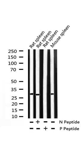 Polyclonal Rabbit anti-Human CCND3 / Cyclin D3 Antibody (phospho-Thr283, IHC, IF, WB)