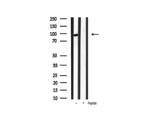 Polyclonal Rabbit anti-Human CTNNB1 / Beta Catenin Antibody (phospho-Ser33, IHC, IF, WB)