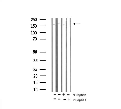 Polyclonal Rabbit anti-Human Tuberin / TSC2 Antibody (phospho-Thr1462, IHC, IF, WB)