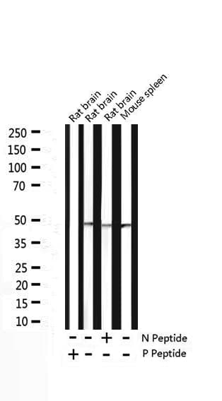 Polyclonal Rabbit anti-Human CASP9 / Caspase 9 Antibody (phospho-Thr125, IHC, IF, WB)