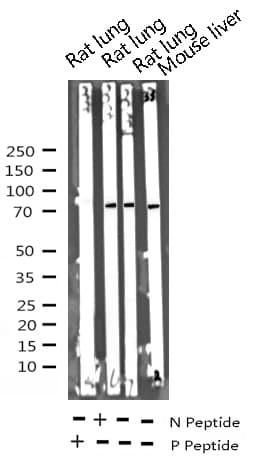 RELA / NFKB p65 Antibody (phospho-Ser276)