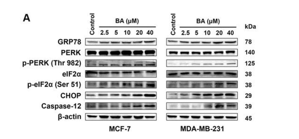 Polyclonal Rabbit anti-Human EIF2S1 Antibody (IHC, IF, WB)