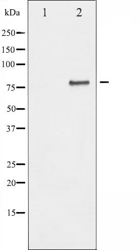 Polyclonal Rabbit anti-Human CHUK / IKKA / IKK Alpha Antibody (IHC, IF, WB)
